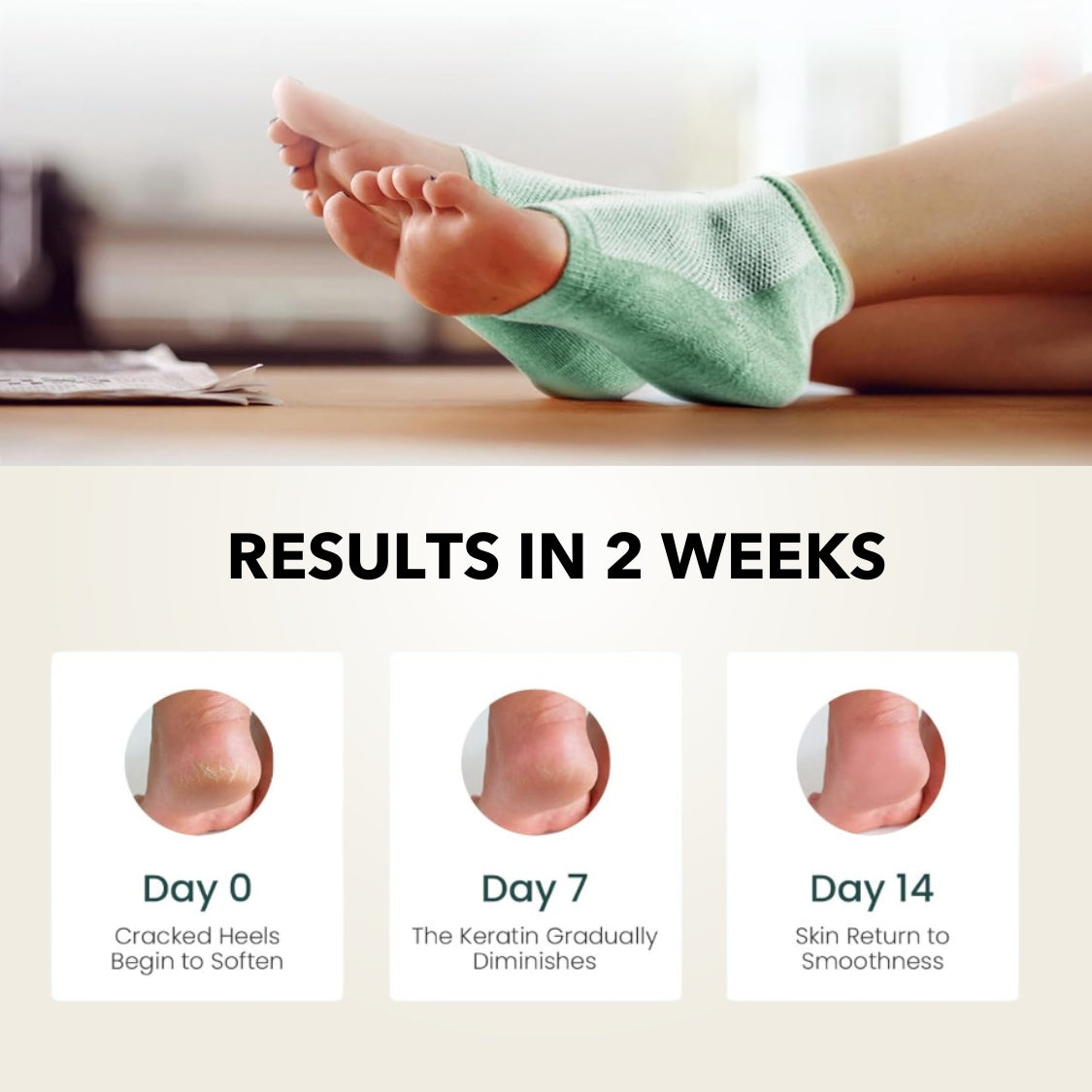 4 Pcs Moisturizing Heel Socks