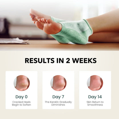 4 Pcs Moisturizing Heel Socks