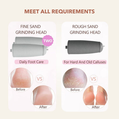 SpaSculpt Pro Pedicure & Callus Remover