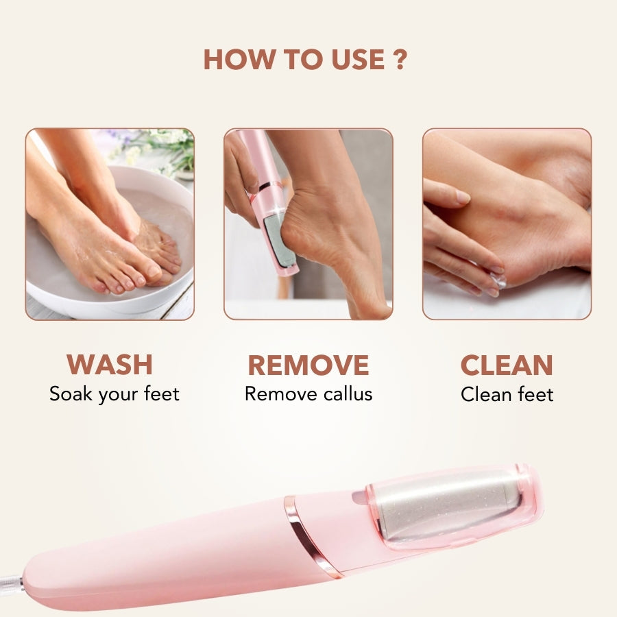 SpaSculpt Pro Pedicure & Callus Remover