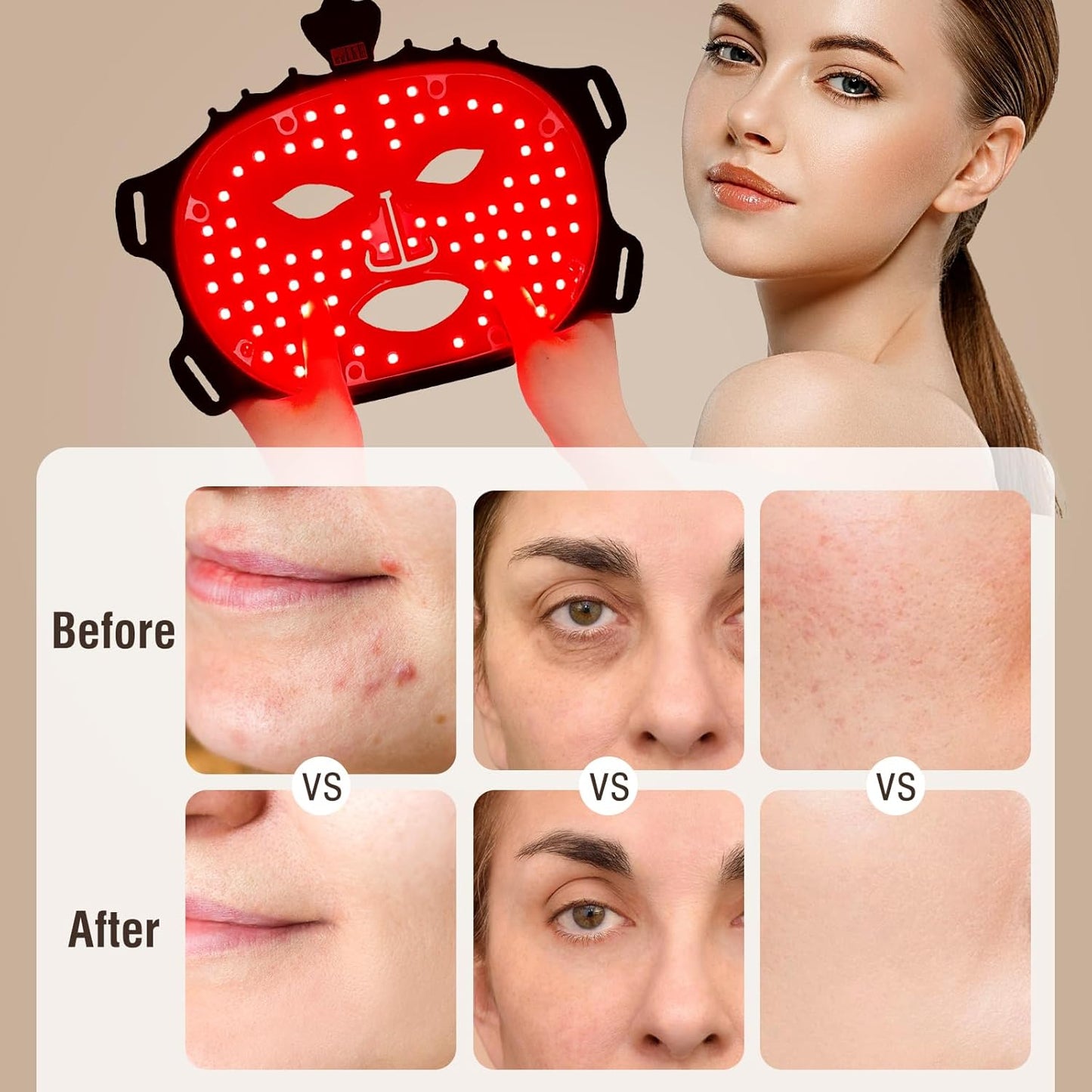 Face Mask Light Therapy Gen.2