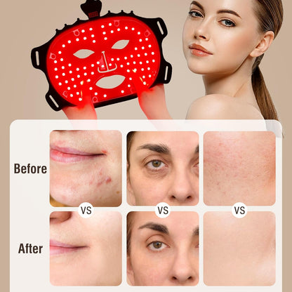 Face Mask Light Therapy Gen.2
