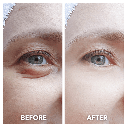 LumiLift™ Eye Perfector