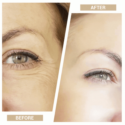 3-in-1 Mini Facial Toning & Rejuvenation Device V2