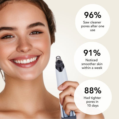 Blackhead Remover Pore Vacuum Cleaner