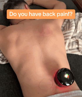 4-in-1 Smart Cupping Therapy Massager & Red Light Therapy
