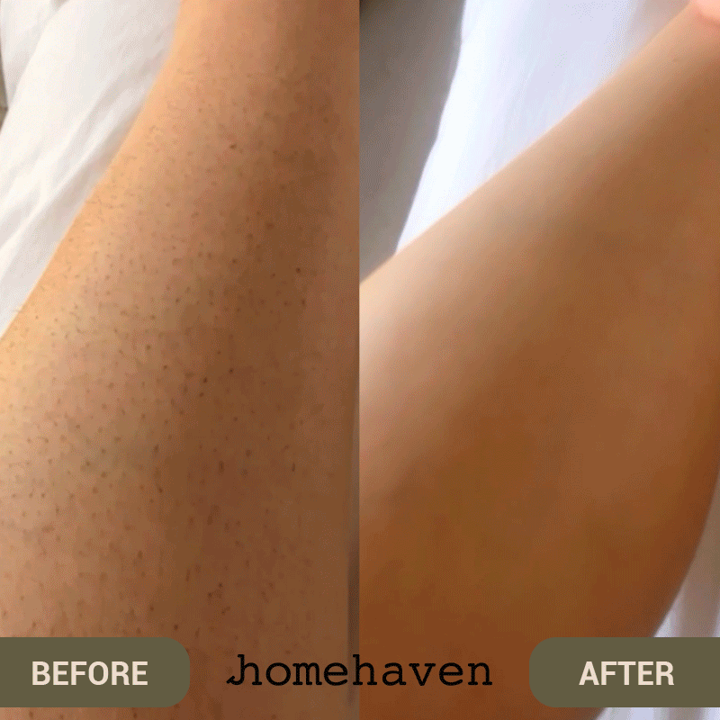 Reusable Crystal Hair Remover Pro