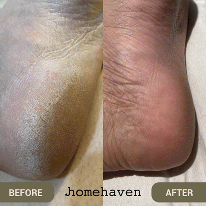 SpaSculpt Pro Pedicure & Callus Remover