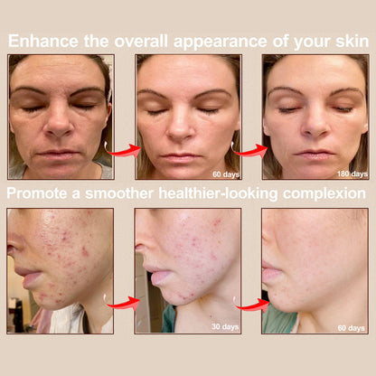 Face Mask Light Therapy Gen.2