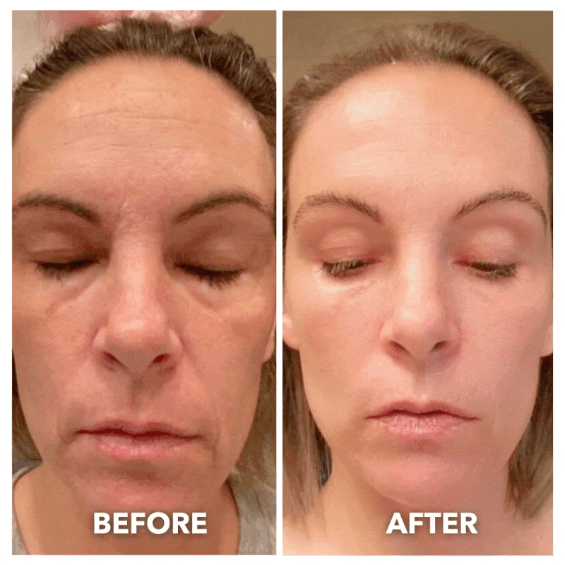 7-in-1 LED Facial Toning & Rejuvenation Wand