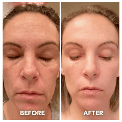 7-in-1 LED Facial Toning & Rejuvenation Wand