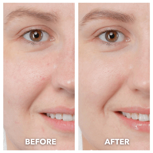 ThermaLift 5-in-1 Facial Sculptor & Cleanser Device V3