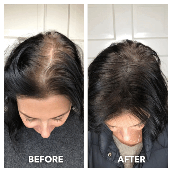 RootHaven™ Luxury Scalp Treatment At Home
